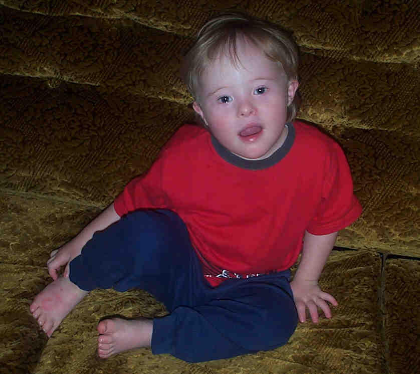 Jacob, a child with Down Syndrome aged 3 years.