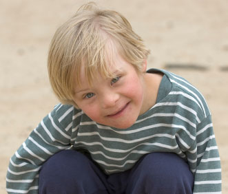 Same boy with Down syndrome from different angle and expression