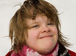 Closeup of face of older girl with Down syndrome