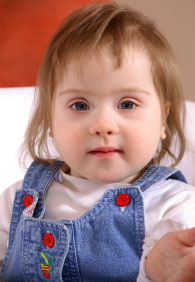 toddler girl with Down syndrome