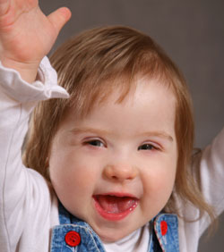 Girl toddler with Downs syndrome