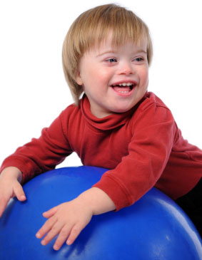 Infant with Downs syndrome