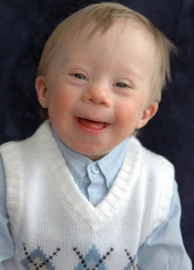 Young boy with Downs syndrom