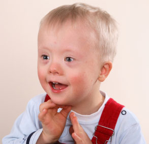 Young male child with Down's syndrome / trisonomy 21